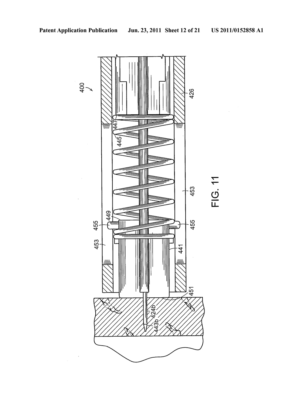 SURGICAL INSTRUMENT COMPRISING AN ELECTRODE - diagram, schematic, and image 13