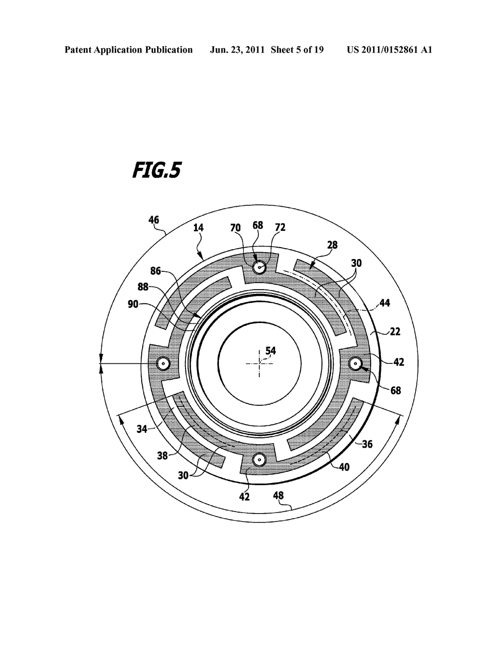 Surgical System For Connecting Body Tissue - diagram, schematic, and image 06