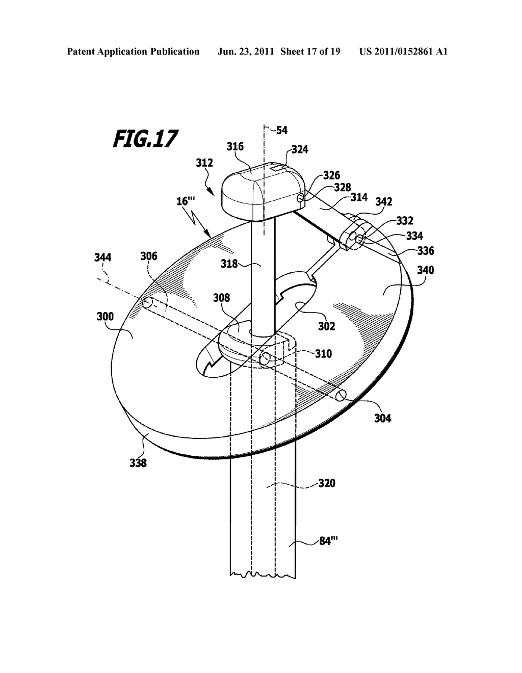 Surgical System For Connecting Body Tissue - diagram, schematic, and image 18