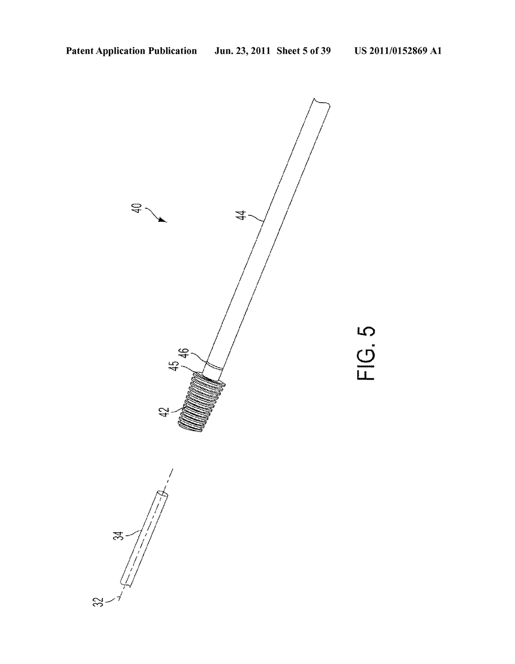 Bone Resurfacing System and Method - diagram, schematic, and image 06