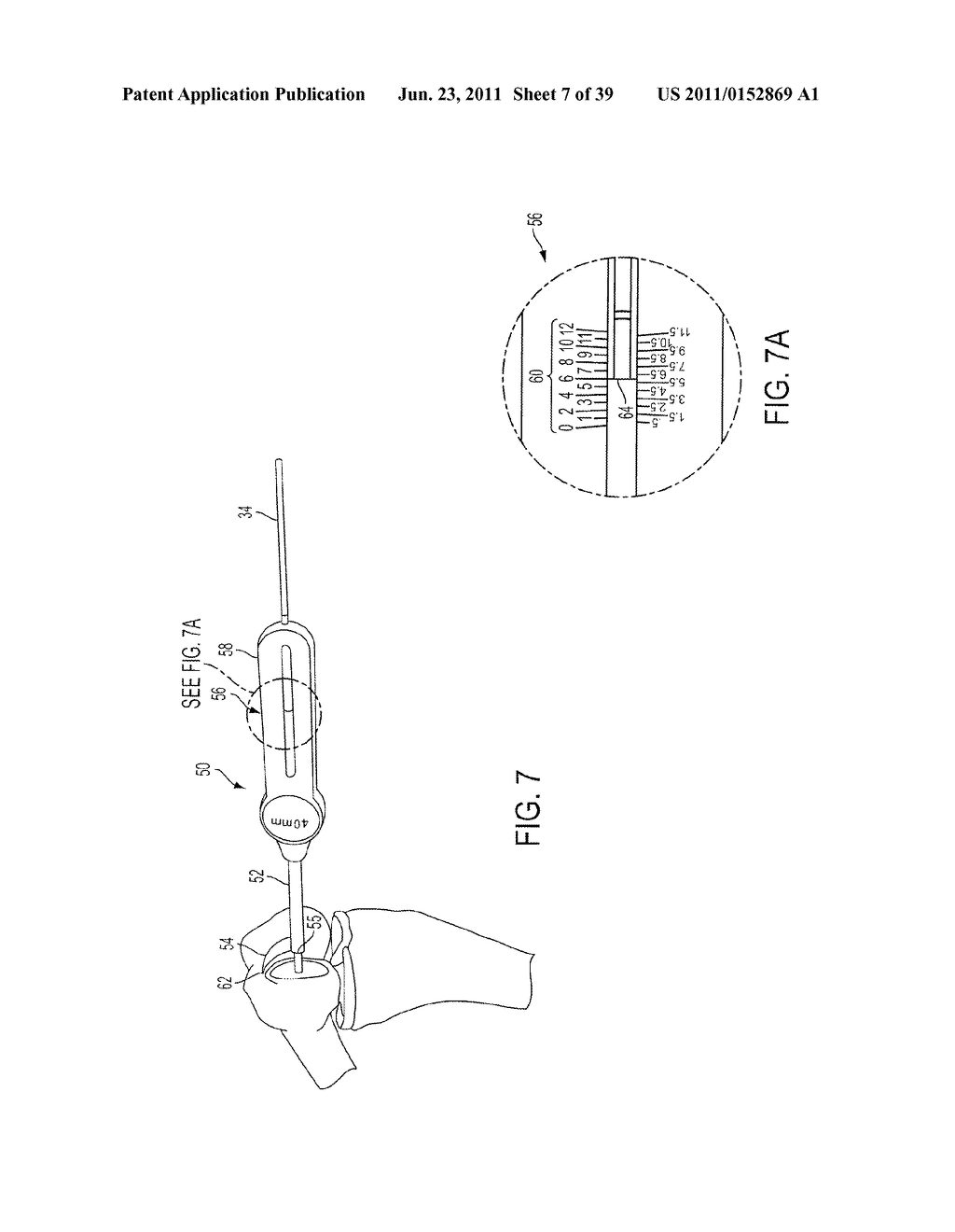 Bone Resurfacing System and Method - diagram, schematic, and image 08