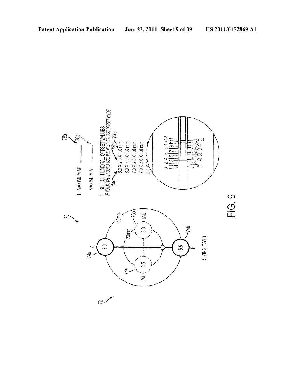 Bone Resurfacing System and Method - diagram, schematic, and image 10