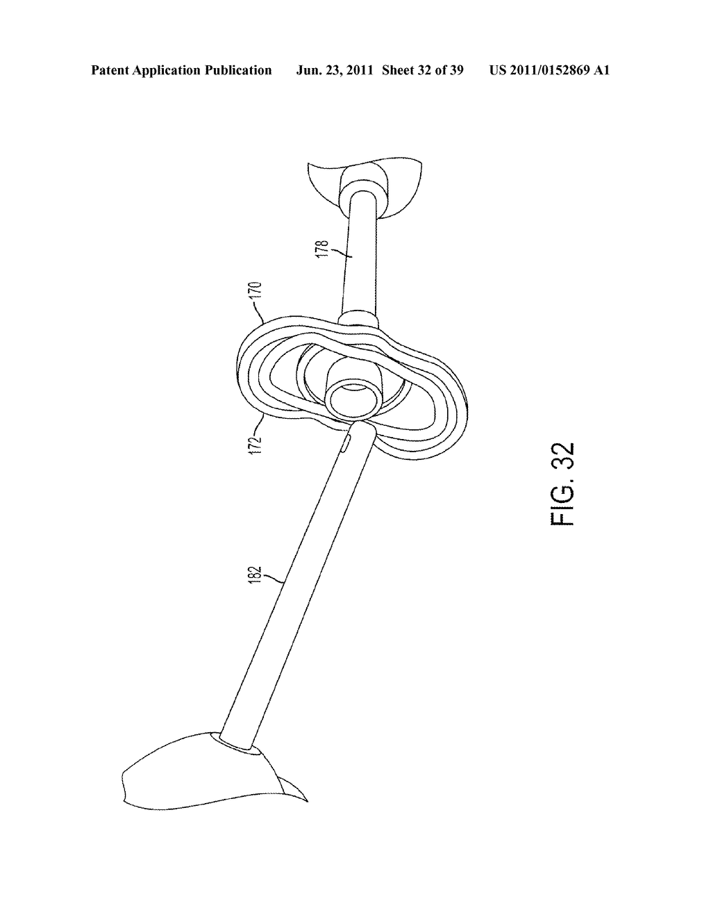 Bone Resurfacing System and Method - diagram, schematic, and image 33