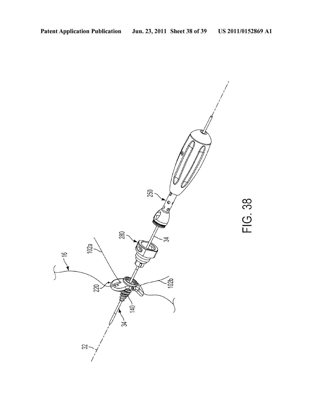 Bone Resurfacing System and Method - diagram, schematic, and image 39