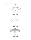 TISSUE EXPANDERS AND METHODS OF USE diagram and image