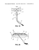 TISSUE EXPANDERS AND METHODS OF USE diagram and image