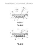 TISSUE EXPANDERS AND METHODS OF USE diagram and image