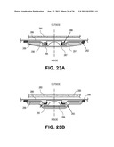 TISSUE EXPANDERS AND METHODS OF USE diagram and image