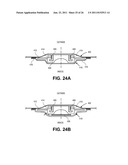 TISSUE EXPANDERS AND METHODS OF USE diagram and image