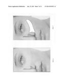 Adjustable nasal passage expander diagram and image