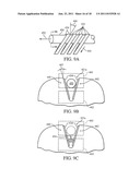 REATTACHMENT OF TISSUE TO BASE TISSUE diagram and image