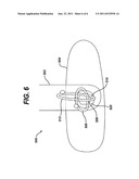 SUTURE ANCHOR INSERTER diagram and image