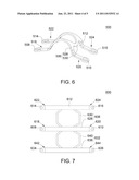 Flexible Spine Fixing Structure diagram and image