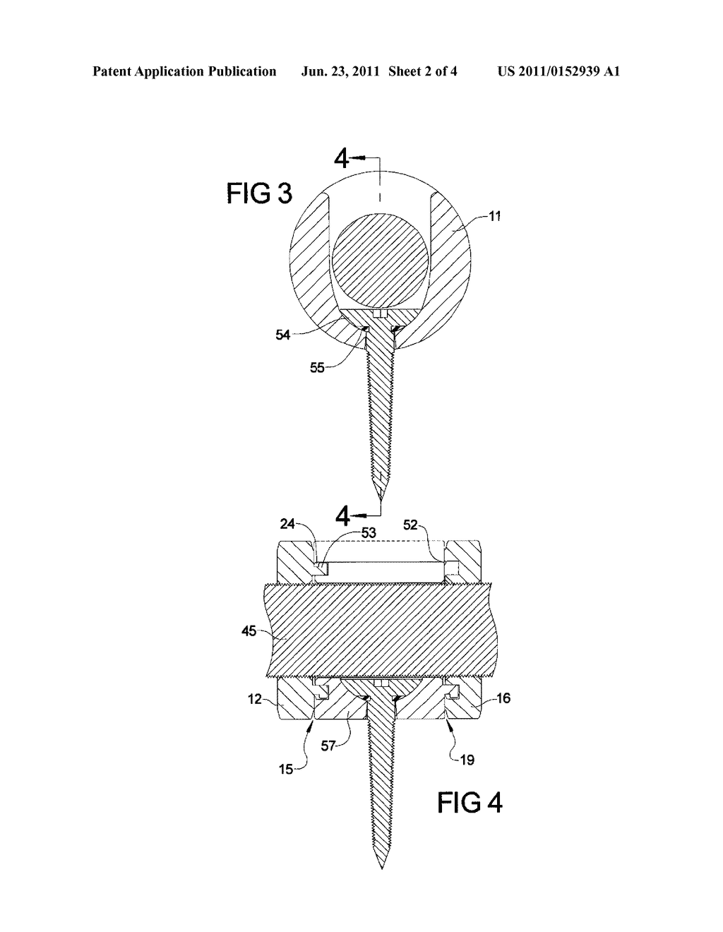 APPARATUS AND SYSTEM FOR VERTEBRAE STABILIZATION AND CURVATURE CORRECTION,     AND METHODS OF MAKING AND USING SAME - diagram, schematic, and image 03