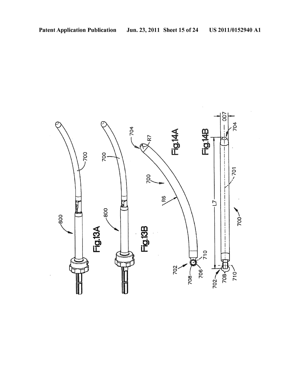 METHODS OF SPINAL FIXATION AND INSTRUMENTATION - diagram, schematic, and image 16