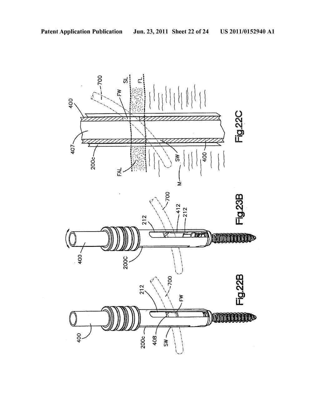 METHODS OF SPINAL FIXATION AND INSTRUMENTATION - diagram, schematic, and image 23