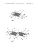 EXTRA-DISCAL ASSEMBLY FOR INTERVERTERBRAL STABILISATION FOR ARTHRODESIS diagram and image