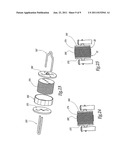 EXTRA-DISCAL ASSEMBLY FOR INTERVERTERBRAL STABILISATION FOR ARTHRODESIS diagram and image