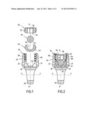 SPINAL IMPLANT diagram and image