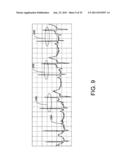 CHAOS-BASED DETECTION OF ATRIAL FIBRILLATION USING AN IMPLANTABLE MEDICAL     DEVICE diagram and image