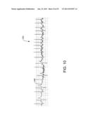 CHAOS-BASED DETECTION OF ATRIAL FIBRILLATION USING AN IMPLANTABLE MEDICAL     DEVICE diagram and image