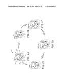 SYSTEM AND METHOD OF AV INTERVAL SELECTION IN AN IMPLANTABLE MEDICAL     DEVICE diagram and image