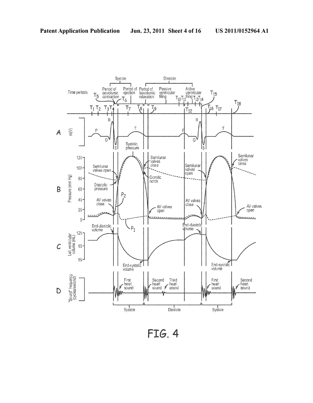 SYSTEM AND METHOD OF AV INTERVAL SELECTION IN AN IMPLANTABLE MEDICAL     DEVICE - diagram, schematic, and image 05