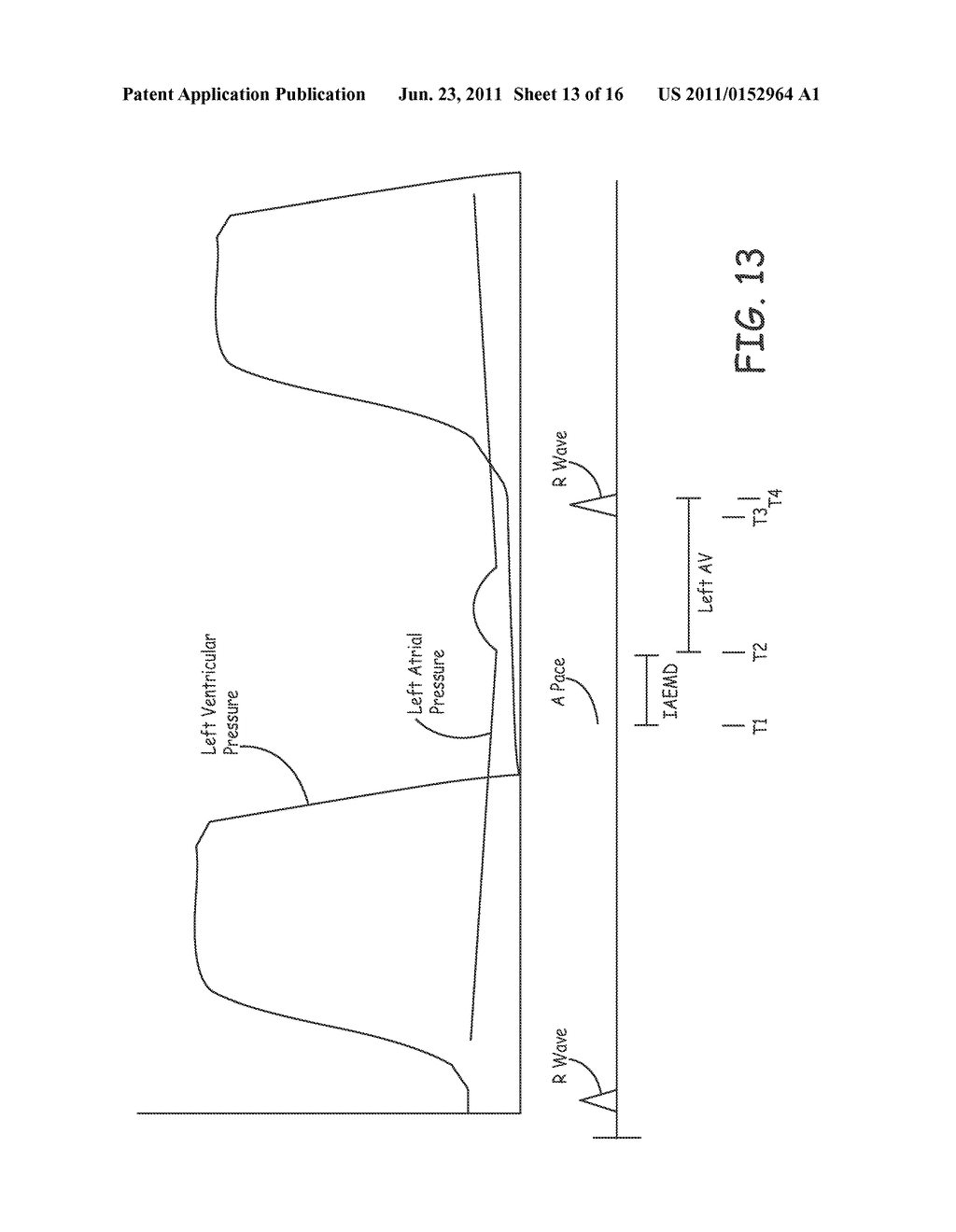 SYSTEM AND METHOD OF AV INTERVAL SELECTION IN AN IMPLANTABLE MEDICAL     DEVICE - diagram, schematic, and image 14