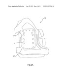 ORTHOSIS FOR A GAIT MODULATION SYSTEM diagram and image