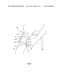 ORTHOSIS FOR A GAIT MODULATION SYSTEM diagram and image