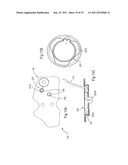 ORTHOSIS FOR A GAIT MODULATION SYSTEM diagram and image