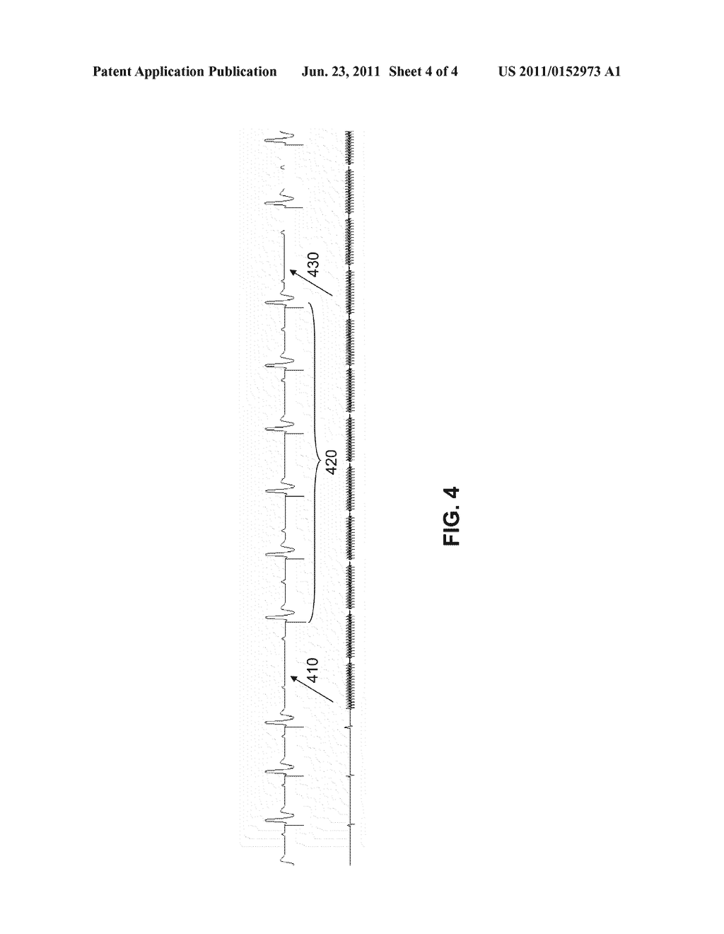 EXTENDED NOISE MODE - diagram, schematic, and image 05