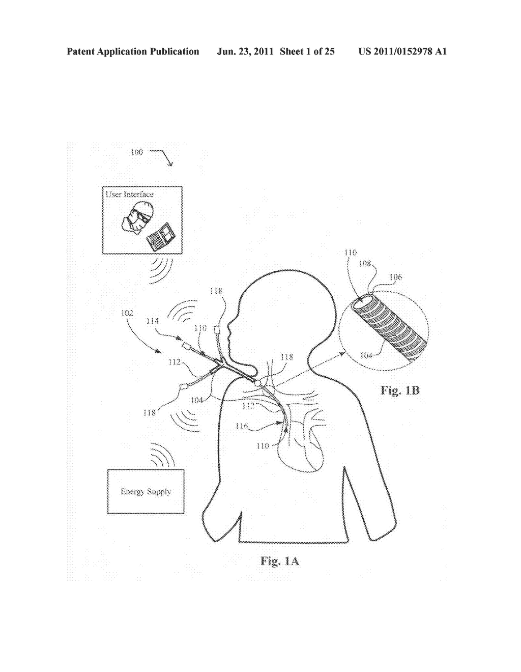 Systems, devices, and methods including catheters configured to monitor     biofilm formation having biofilm spectral information configured as a     data structure - diagram, schematic, and image 02