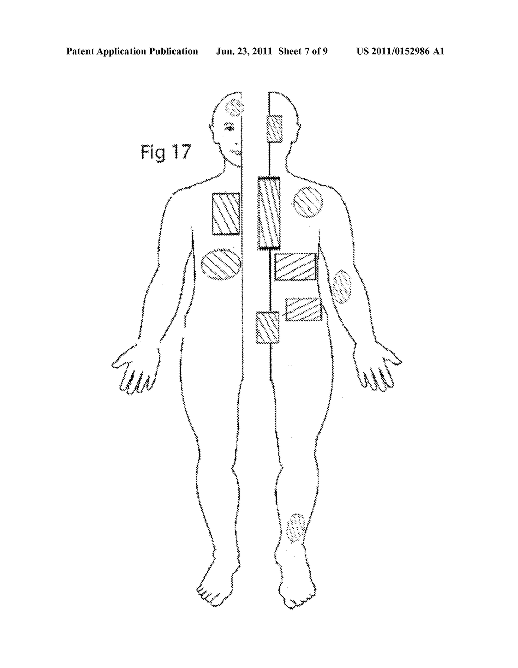 THERAPEUTIC DEVICE AND METHOD - diagram, schematic, and image 08