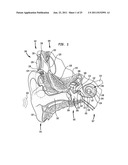 STRAIN RELIEF IN AN IMPLANTABLE ELECTRODE ASSEMBLY diagram and image