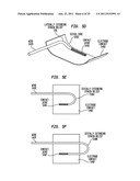 STRAIN RELIEF IN AN IMPLANTABLE ELECTRODE ASSEMBLY diagram and image