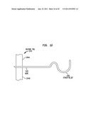 STRAIN RELIEF IN AN IMPLANTABLE ELECTRODE ASSEMBLY diagram and image