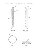 DEVICE AND METHOD FOR TACKING PLAQUE TO BLOOD VESSEL WALL USING WIRE MESH     ANNULAR BAND diagram and image