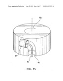 DEVICE AND METHOD FOR TACKING PLAQUE TO BLOOD VESSEL WALL USING WIRE MESH     ANNULAR BAND diagram and image