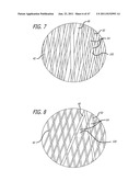 MULTIPLE LAYER FILAMENTARY DEVICES OR TREATMENT OF VASCULAR DEFECTS diagram and image
