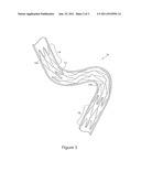 IMPLANTABLE DEVICE diagram and image