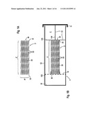 DEVICE AND METHOD FOR PROVIDING A STENT FOR IMPLANTATION diagram and image