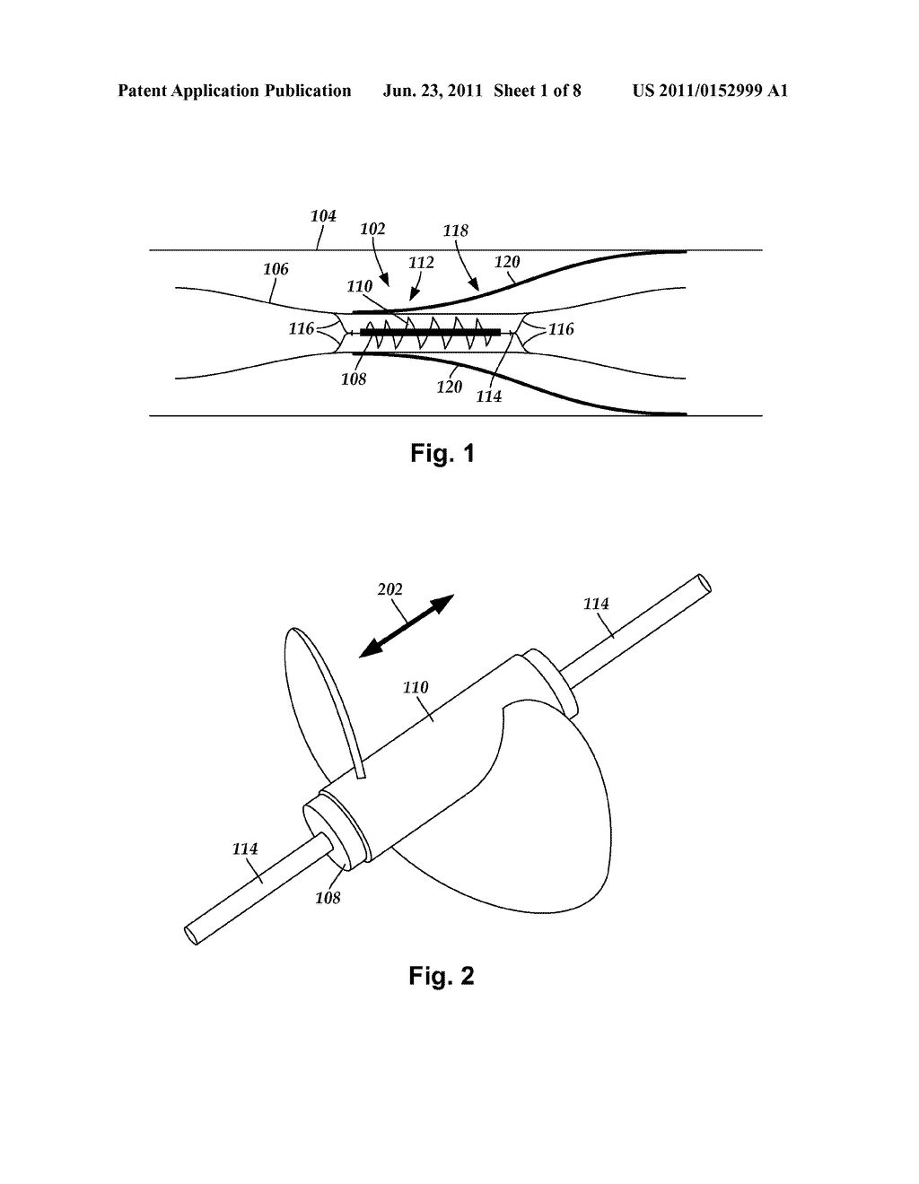 SYSTEMS AND METHODS FOR MAKING AND USING PERCUTANEOUSLY-DELIVERED PUMPING     SYSTEMS FOR PROVIDING HEMODYNAMIC SUPPORT - diagram, schematic, and image 02