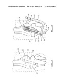 Method and Apparatus for Graft Fixation diagram and image