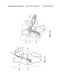 Method and Apparatus for Graft Fixation diagram and image