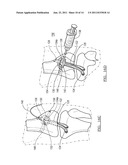 Method and Apparatus for Graft Fixation diagram and image