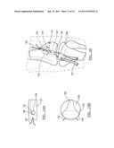 Method and Apparatus for Graft Fixation diagram and image