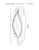 HAND & LEASH COVERING diagram and image