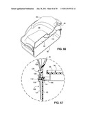 HUMIDIFICATION OF RESPIRATORY GASES diagram and image