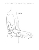 SHOULDER IMMOBILIZER AND FRACTURE STABILIZATION DEVICE diagram and image